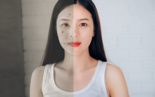피부과 전문의가 알려주는 NAC의 효능과 활용 방법